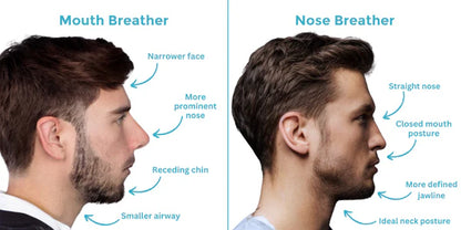Elevate+ Mouth Tape